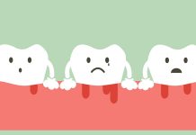 Gum Disease: Stages, Prevention, and Treatment
