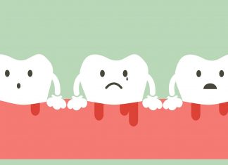 Gum Disease: Stages, Prevention, and Treatment