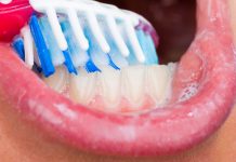 How to maintain Oral Hygiene